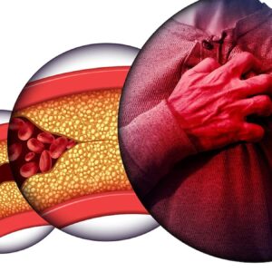 kolesterol dusman mi denge mi rcrTzEAV