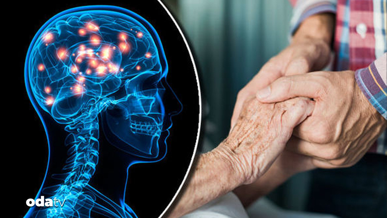 huntington hastaliginda yeni terapi yuzde 75 yavaslama aFOt6fFc